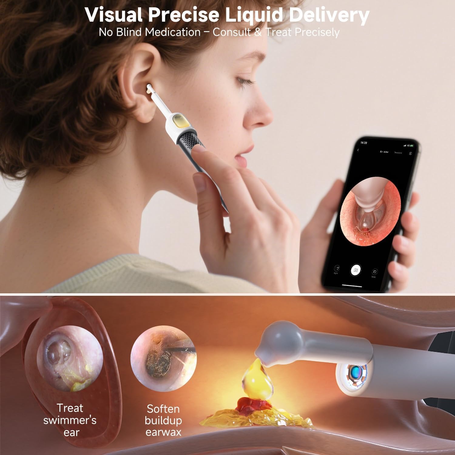 Smart Wireless Ear Camera Kit
